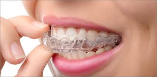 PROFESSIONAL Dental Guards *4pcs